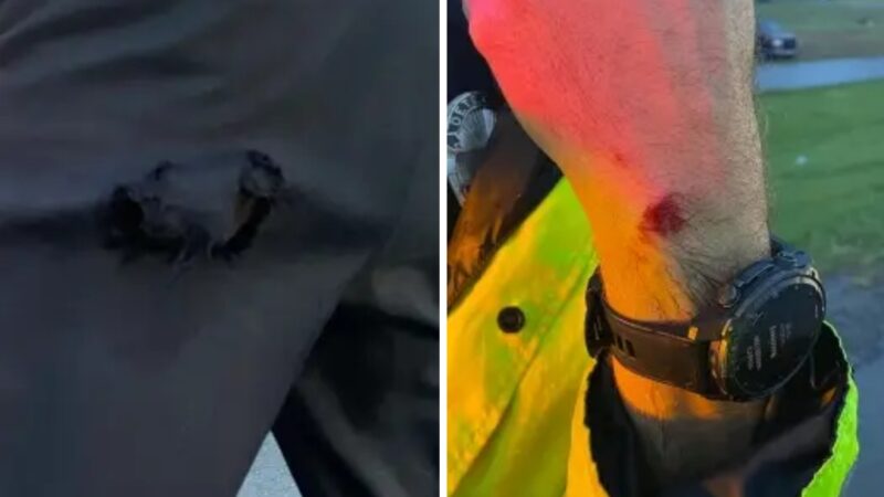 NEW PHOTOS: LMPD just released a new report about the Scottie Scheffler incident, and it includes photos of Det. Bryan Gillis’ injuries and his ripped pants.