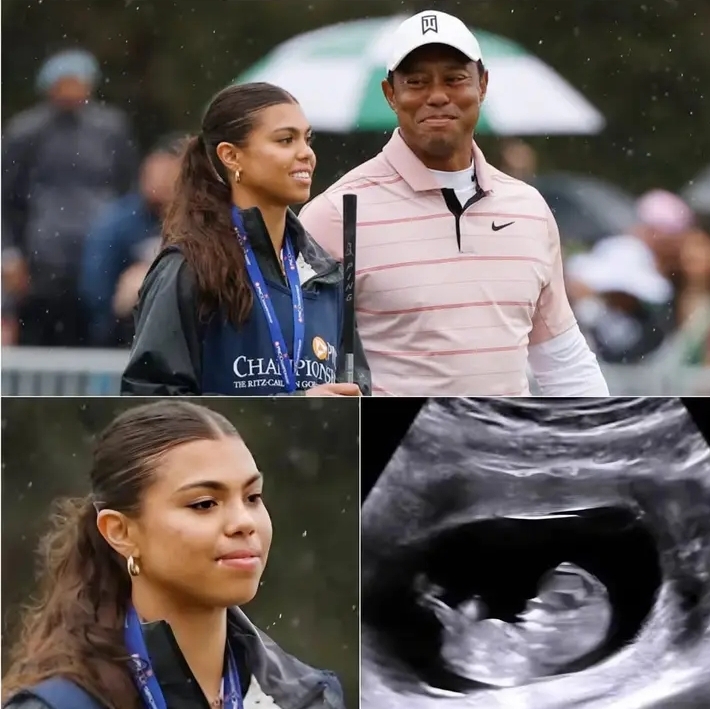 Tiger Woodsโ daughter, Sam Alexis Woods, has revealed sheโs three months pregnant โ and the identity of the ๐๐๐๐ฆโs father will leave you speechless