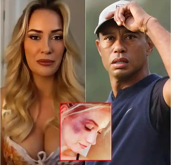 SAD NEWS: Tension In Golf World As Paige Spiranac Files A Restraining Order , Claims Tiger Woods Attacked Her